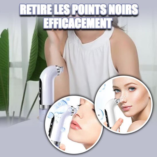 Aspirateur électrique de points noirs™ - Lune de beauté