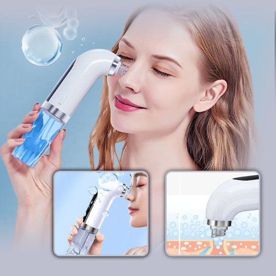 Aspirateur électrique de points noirs™ - Lune de beauté