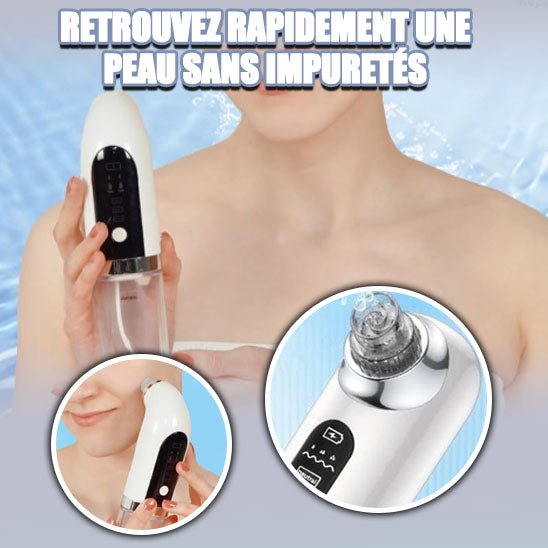 Aspirateur électrique de points noirs™ - Lune de beauté